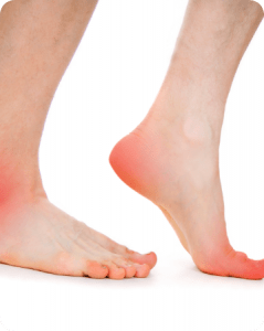 Custom Foot Orthotics | Max Physiotherapy | Physiotherapy, Chiropractic, Massage and Health & Wellness Clinic | NE Calgary