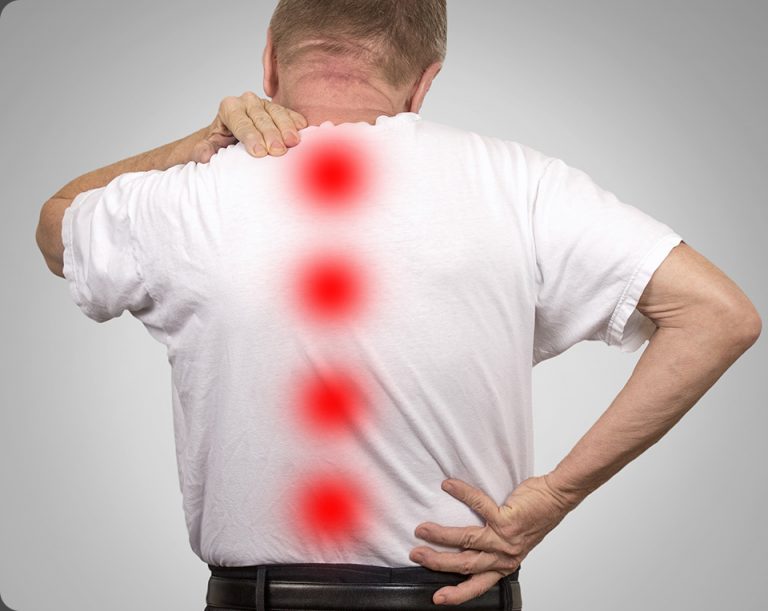 Spinal Stenosis Max Physiotherapy NE Calgary Physio, Chiro